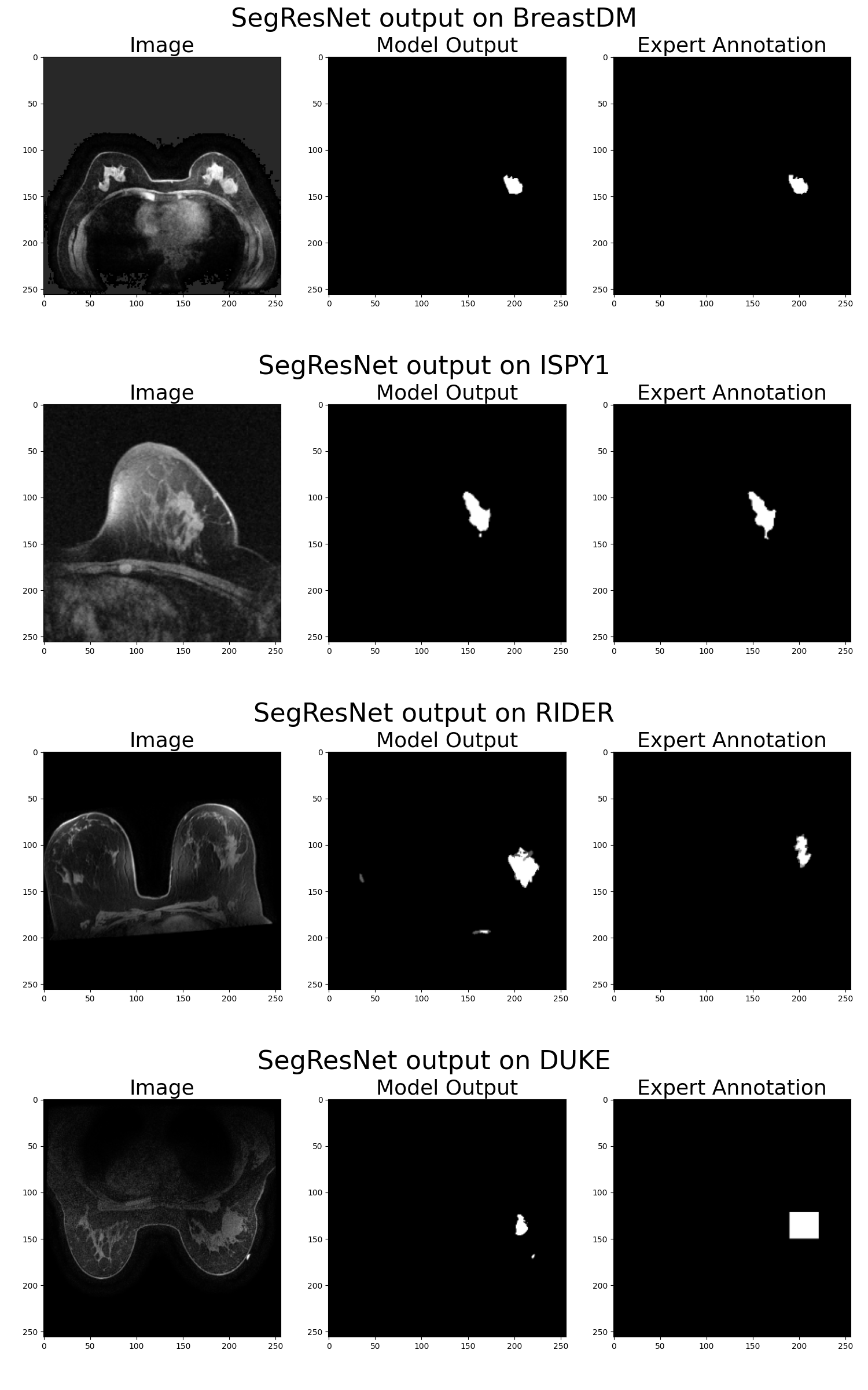 SegResNet Segmentation Mask Outputs